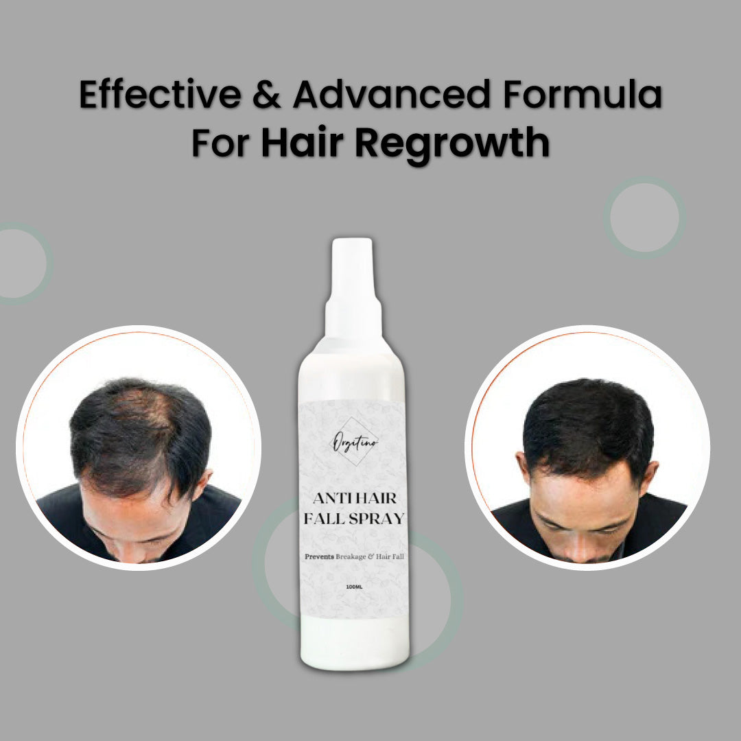 Orgitino's Anti Hair Fall Spray